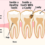 How to Avoid Cavity in Teeth