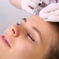 botox-and-injectable-fillers-in-south-edmonton