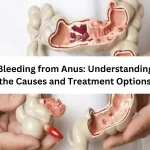 bleeding from the anus